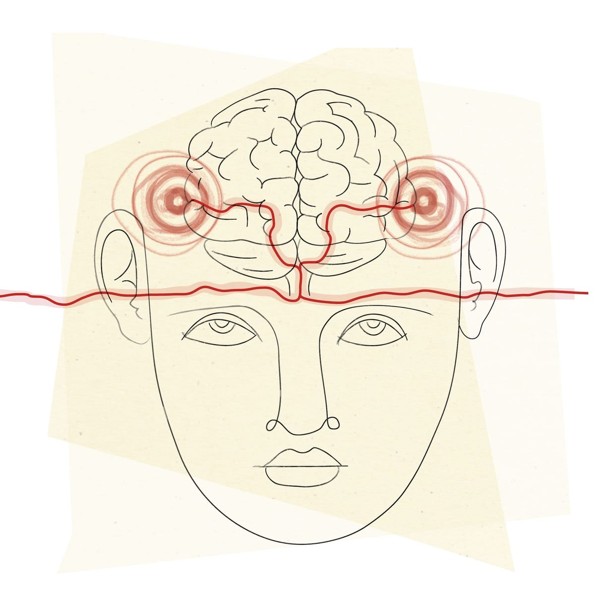 Tinnitus Breakthrough - New Treatments Bring Relief