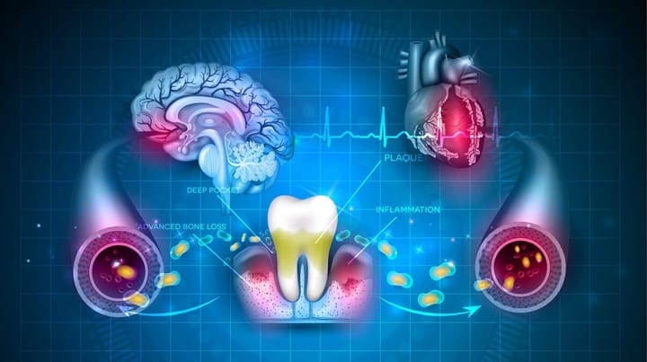 Gum Disease Linked to White Matter Damage in the Brain