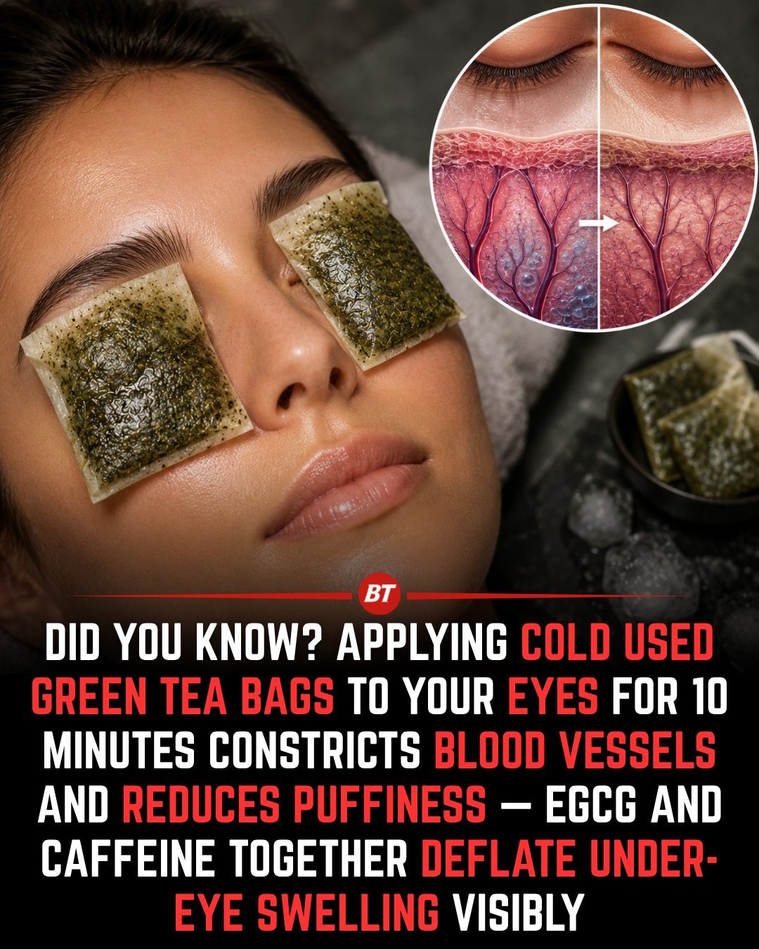 Green Tea: Natural Remedy for Puffy Eyes