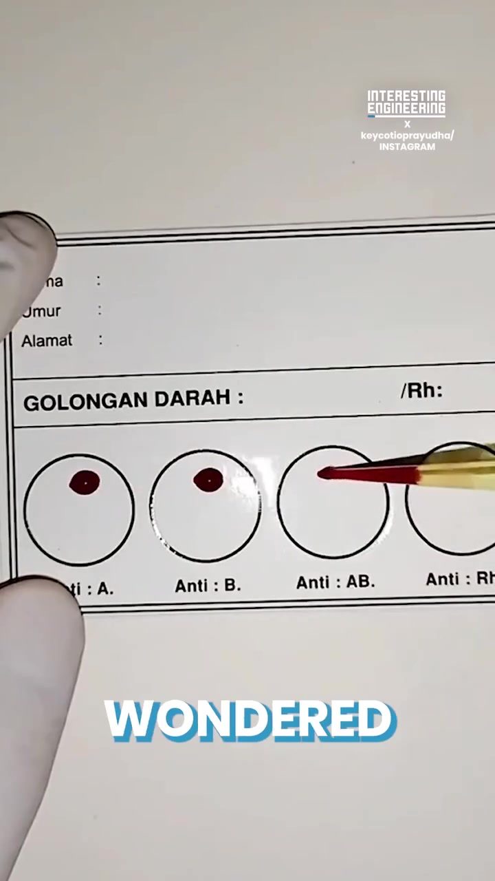 Blood Typing: Step-by-Step Guide to Determining Blood Type