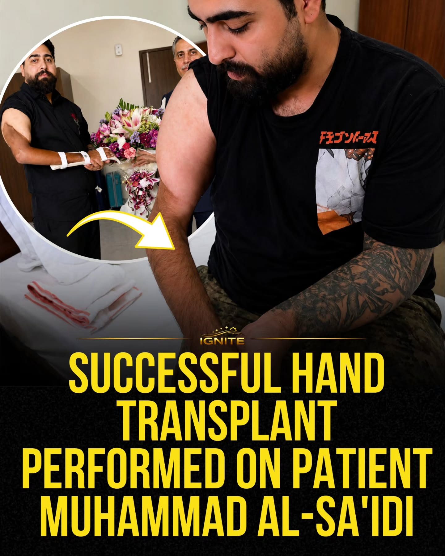 IGNITE's Groundbreaking Hand Transplant on Muhammad Al-Sa'idi