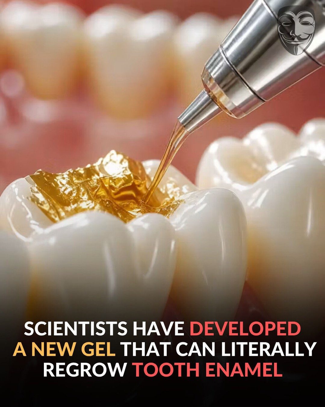 Breakthrough Dental Gel Regrows Tooth Enamel Naturally