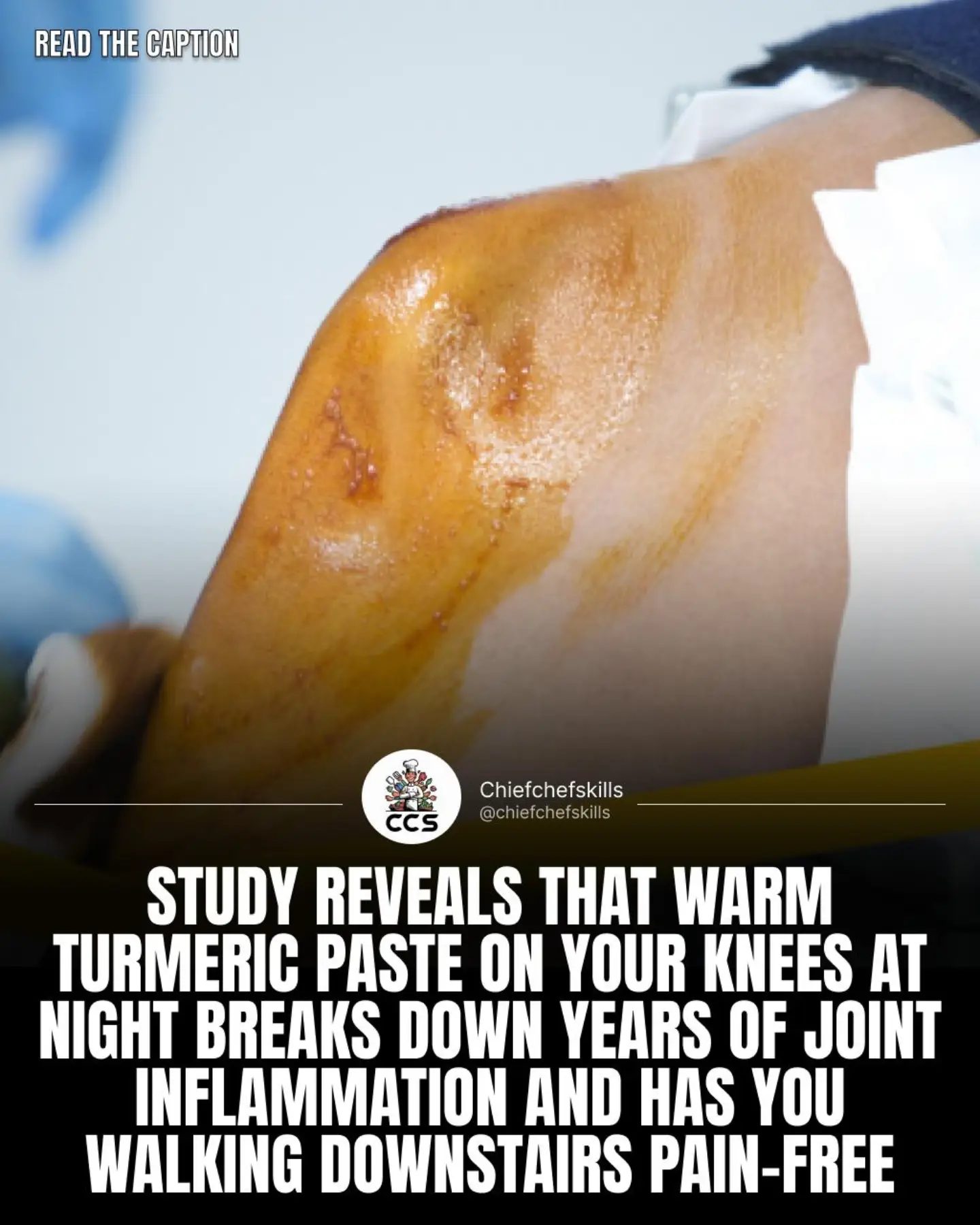 Turmeric Paste: Natural Remedy for Joint Pain Relief