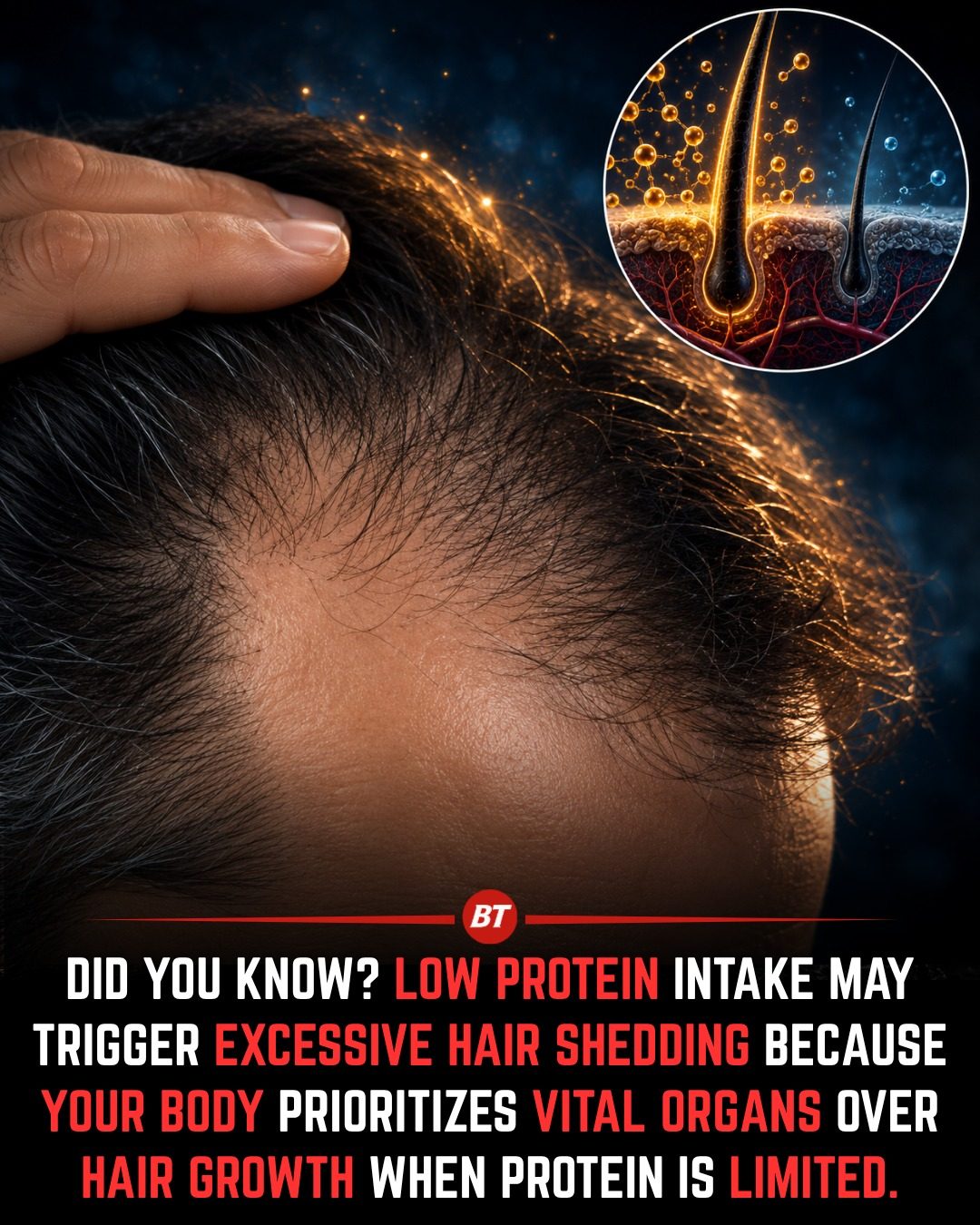 Protein Deficiency and Hair Loss: What You Need to Know