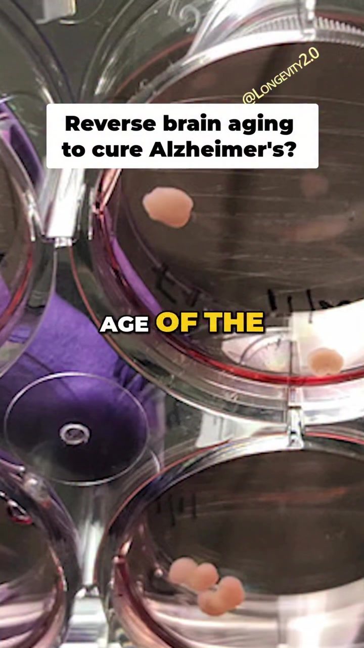 Reversing Brain Aging: A Potential Alzheimer's Cure
