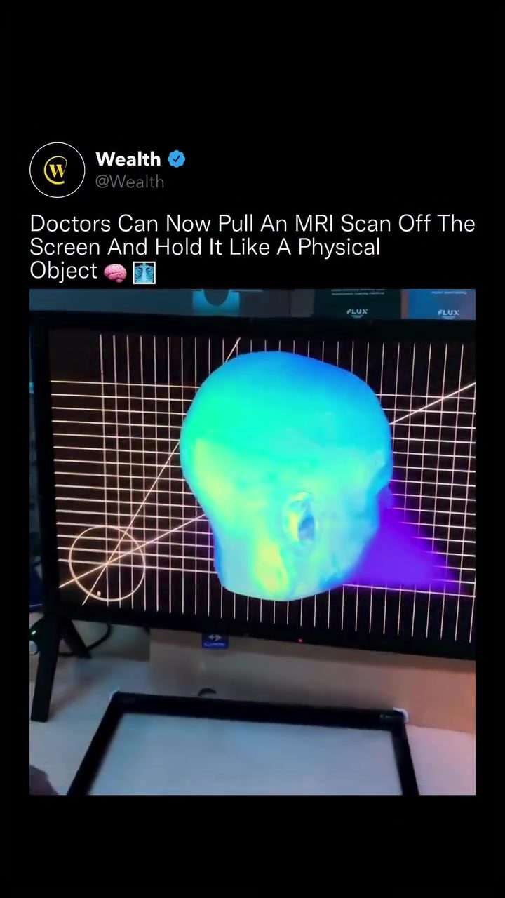 Revolutionizing Medical Imaging: 3D MRI Holograms