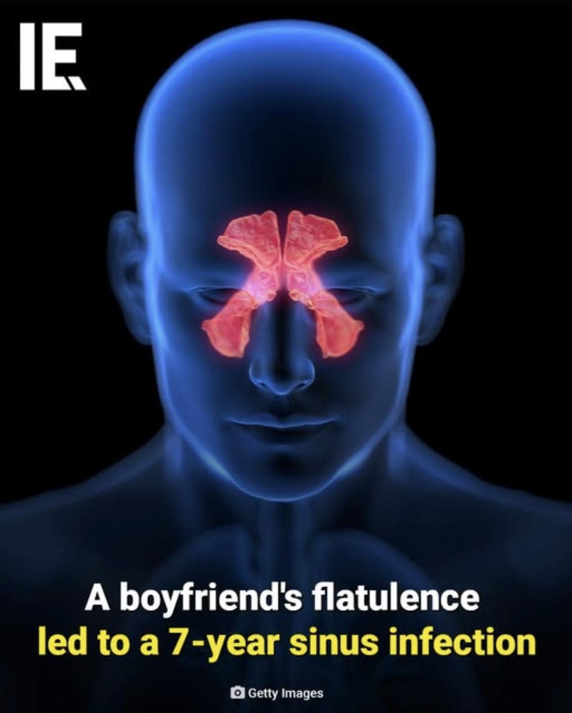 Bizarre: Seven-Year Sinus Infection Caused By Boyfriend's Flatulence
