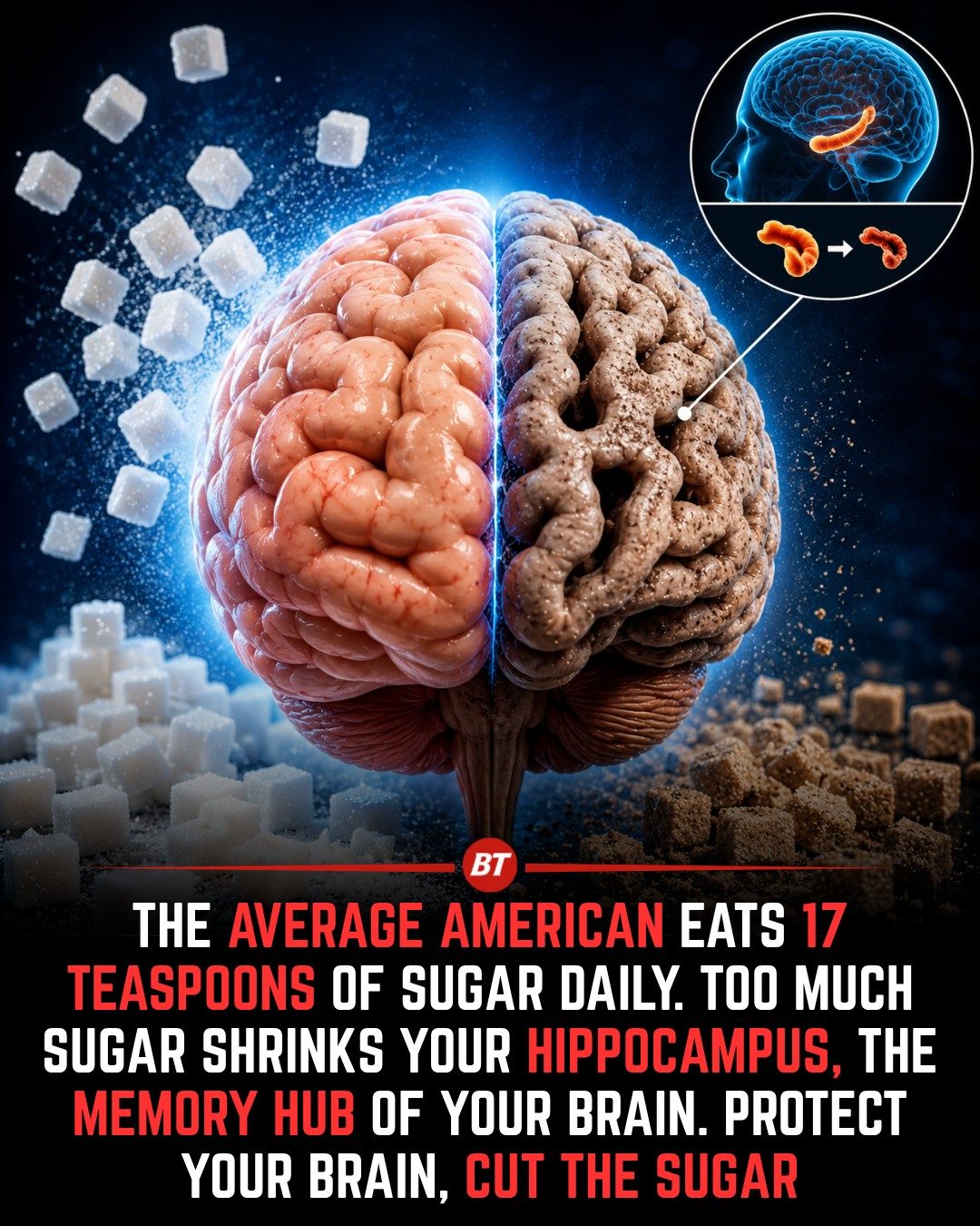 Sugar's Hidden Threat to Your Memory and Brain Health
