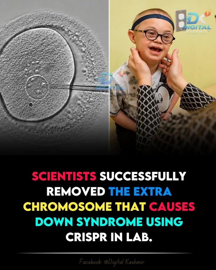 Mie University CRISPR Breakthrough Offers Down Syndrome Hope