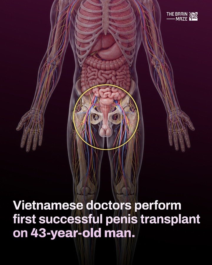 Vietnam's First Penis Transplant: A Medical Breakthrough