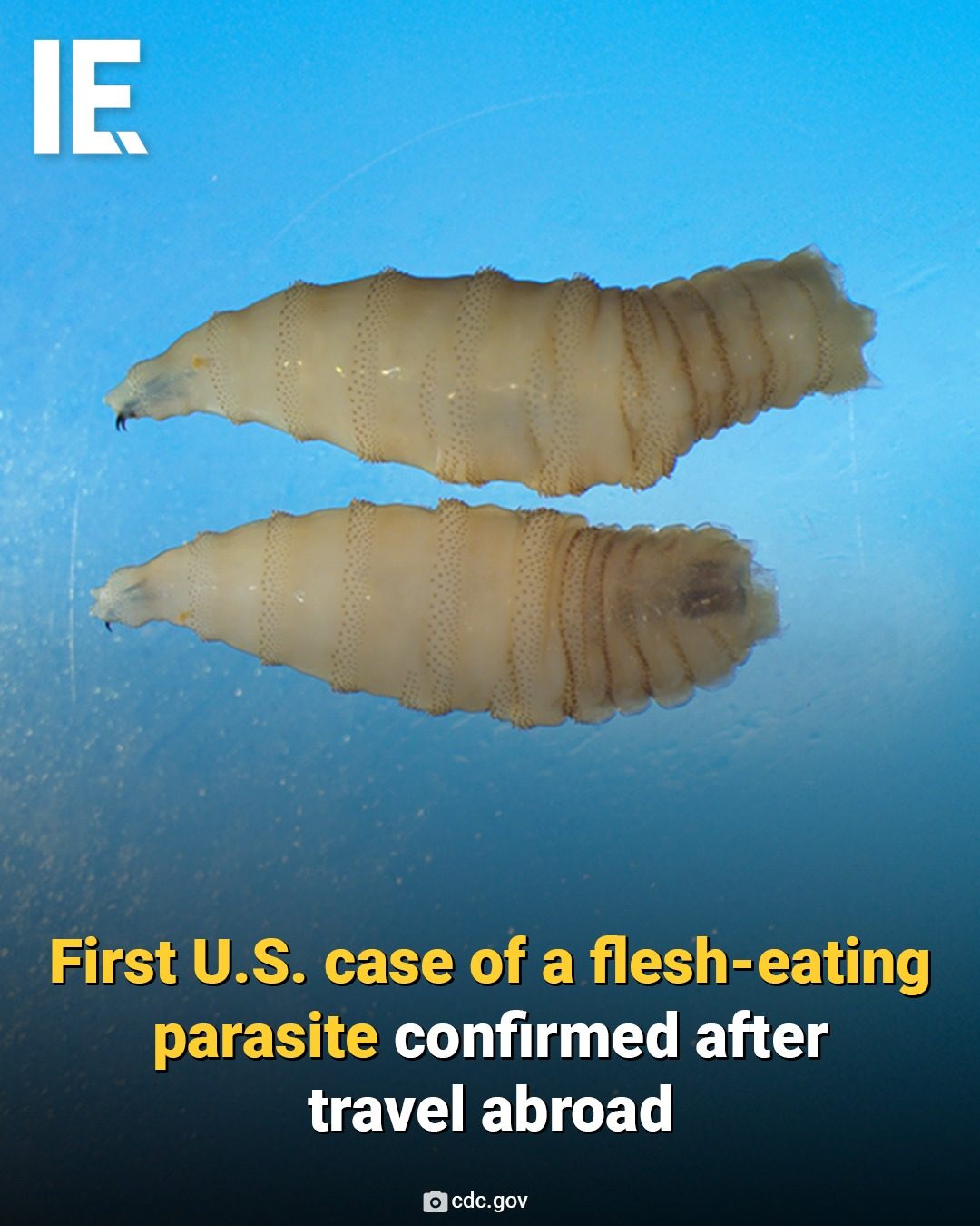 New U.S. Case of Flesh-Eating Parasite Raises Alarm