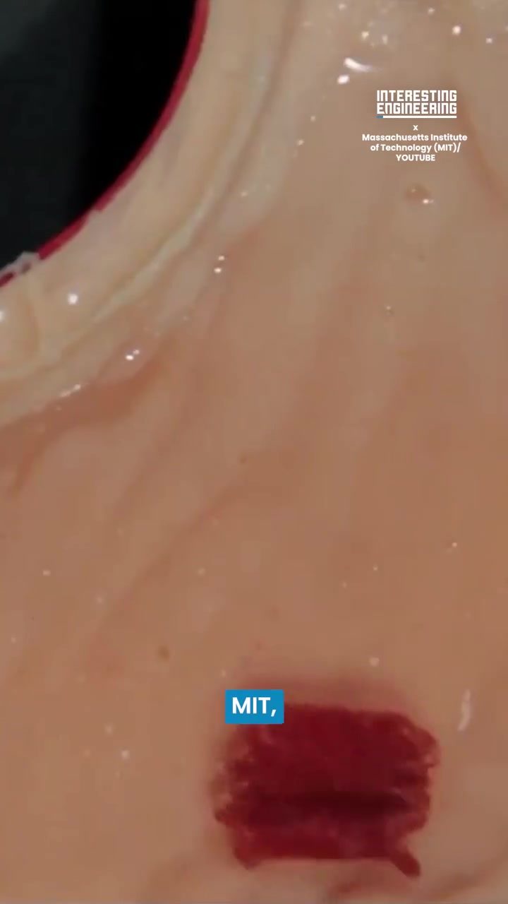 MIT's Swallowable Robot: A Revolution in Minimally Invasive Surgery