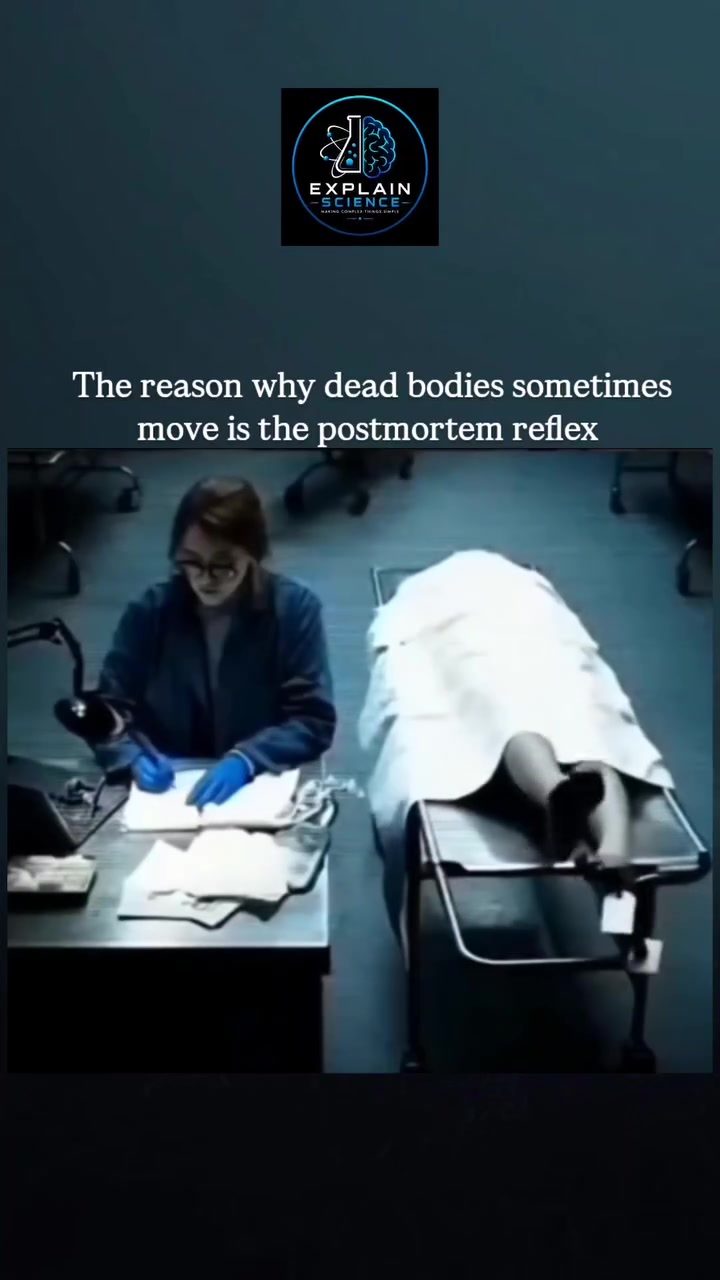 Understanding Postmortem Reflexes: Why Dead Bodies Move