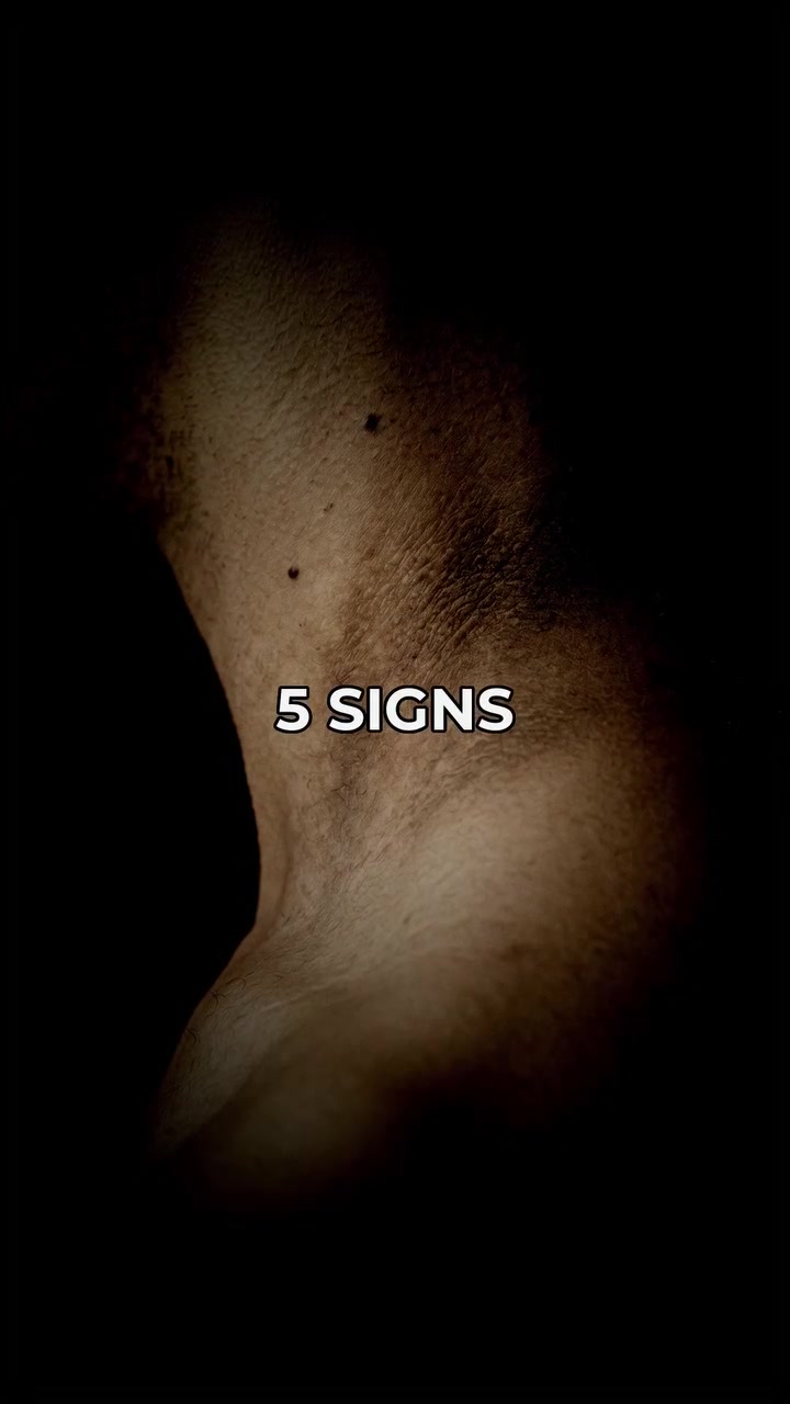 Insulin Resistance Signs and Metabolic Health