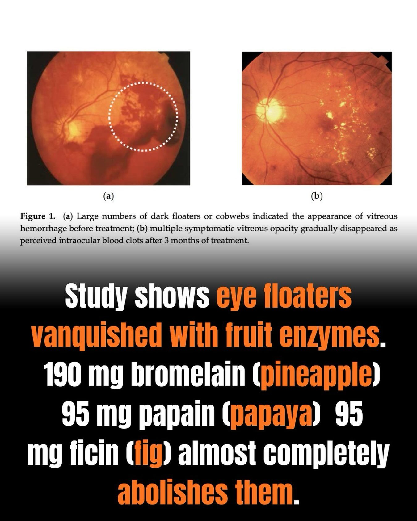Fruit Enzymes Supplements for Eye Floaters Treatment