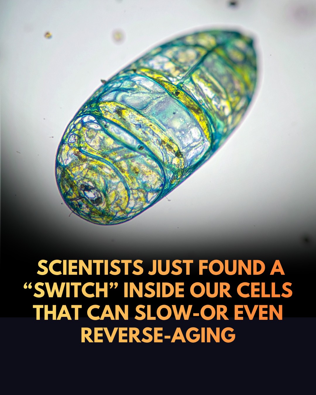 Scientists Find Cellular 'Switch' to Slow Aging