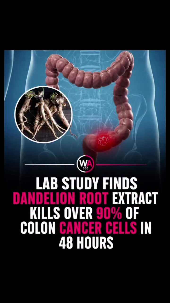 Dandelion Root: Colon Cancer Fighting Potential