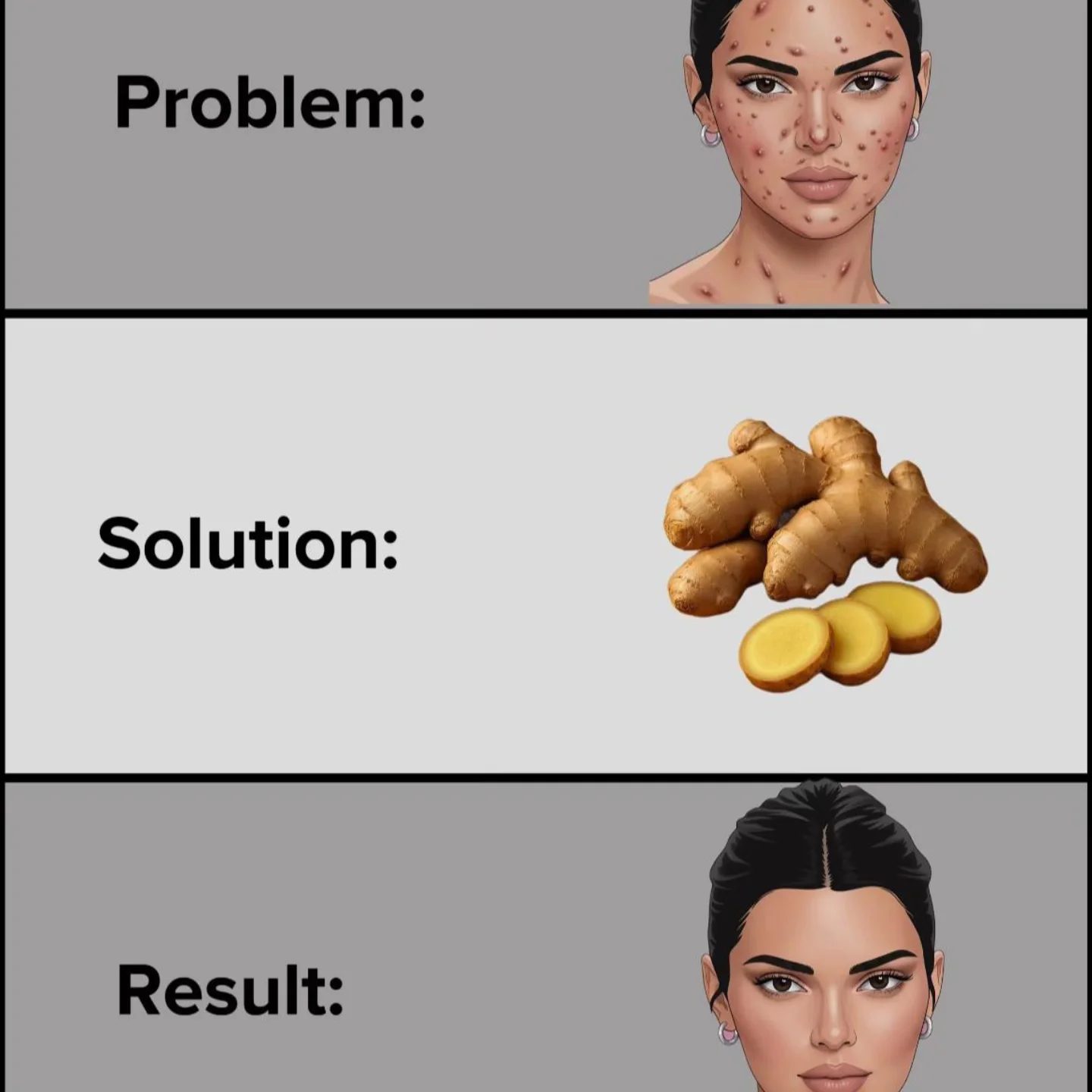 Ginger Root as Effective Acne Treatment