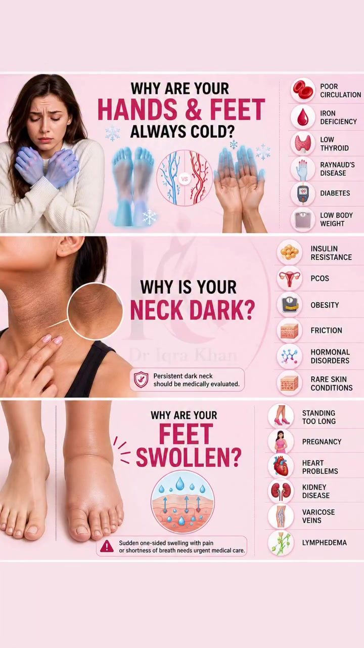 Understanding Cold Hands, Dark Neck, and Swollen Feet