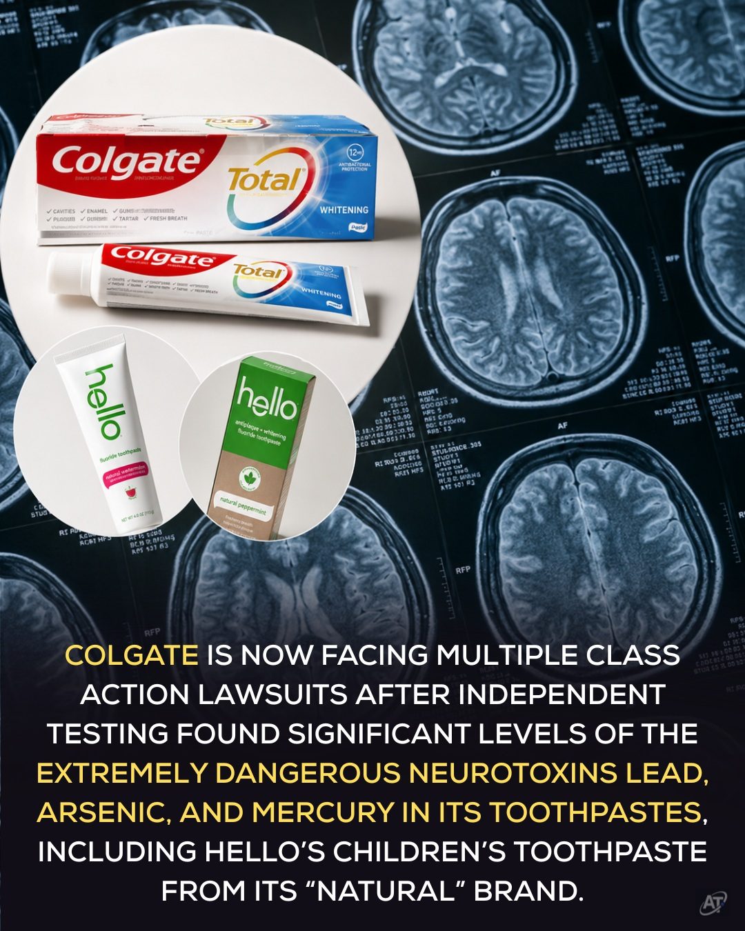 Lawsuit Alert: Lead and Mercury Found in Some Kids' Toothpaste