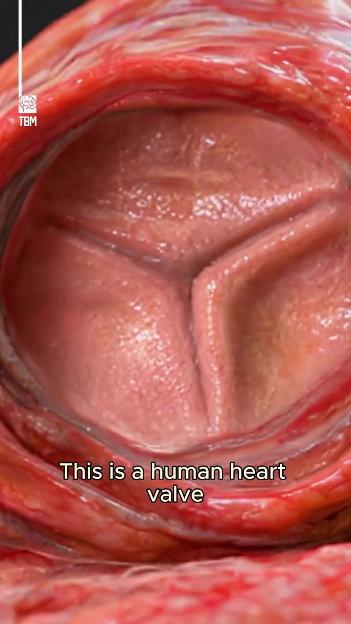 Understanding Heart Valve Replacement: Modern Procedures