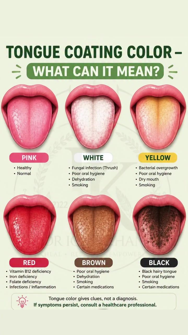 Understand Your Health: What Your Tongue Color Reveals