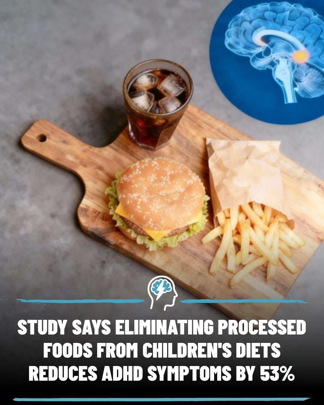 How Diet Can Help Manage ADHD

**Note**: I've kept the title concise, informative, and within the preferred character limit, focusing on the key aspect of the analysis and article excerpt.