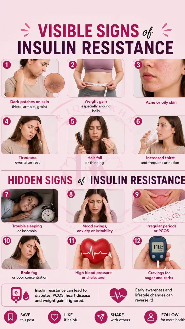 ### Identifying Early Signs of Insulin Resistance