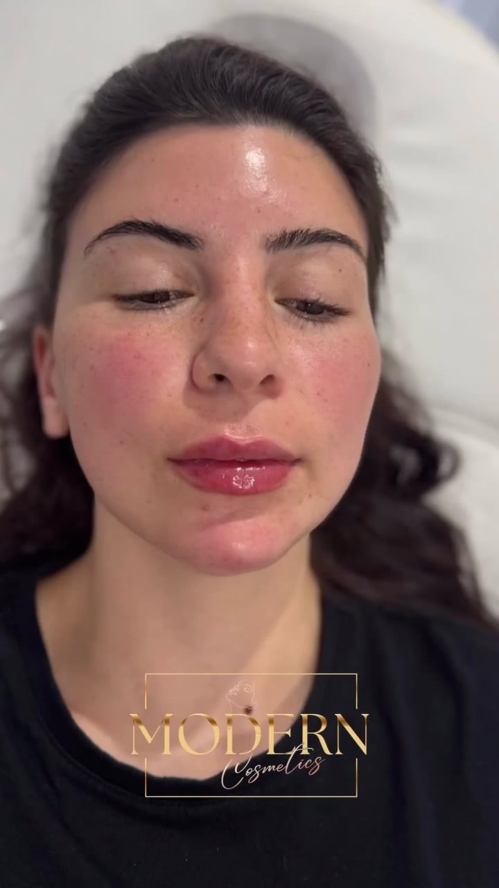 Discover the Art of Personalized Cosmetic Treatments at Modern Cosmetics