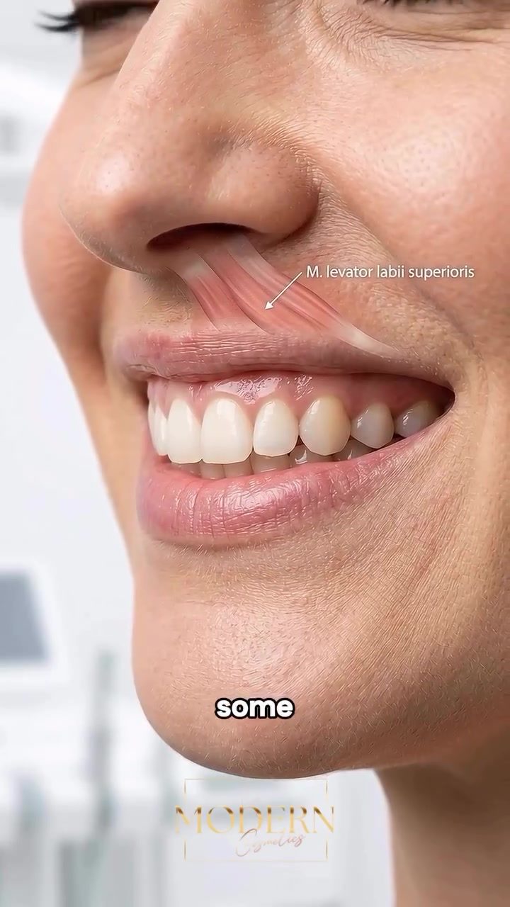 Understanding the Levator Labii Superioris: Causes of Gummy Smiles