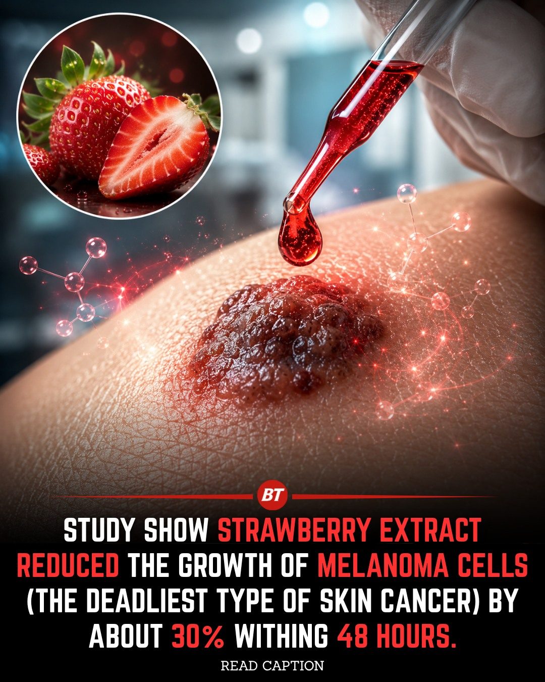 Strawberry Extract Shows Promise in Fighting Melanoma