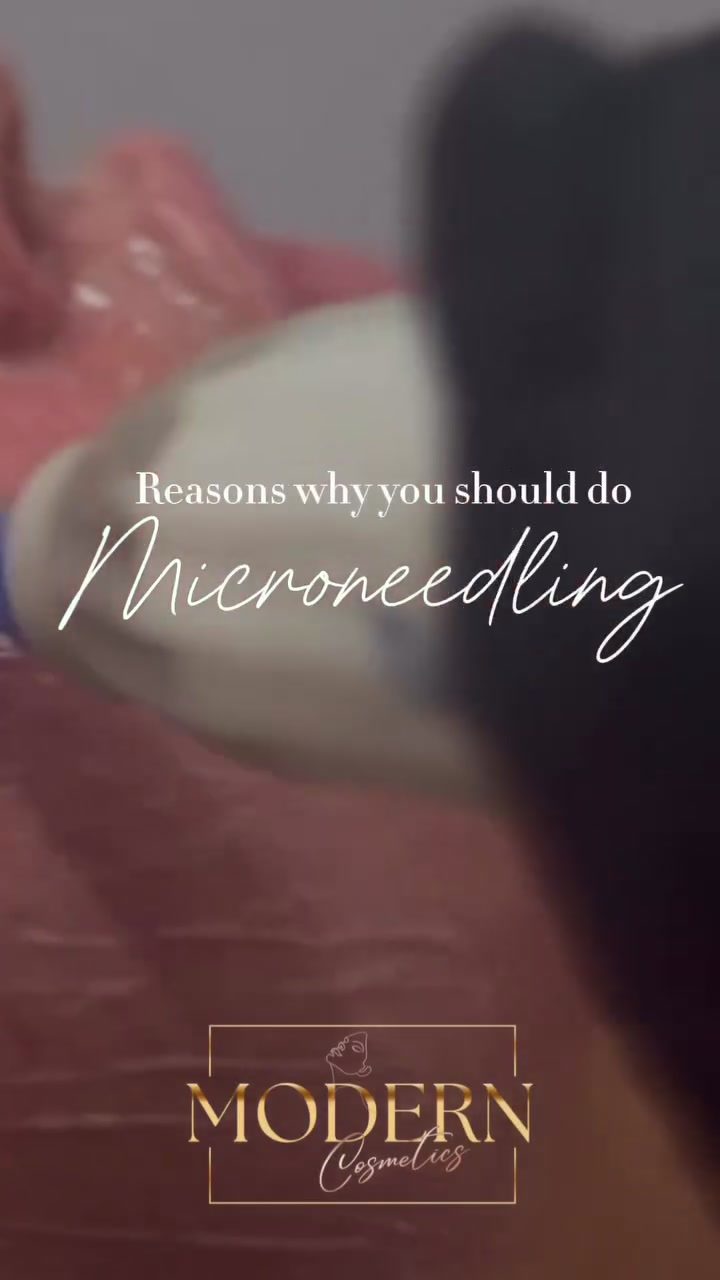 Microneedling Benefits: Enhancing Skin Texture at Modern Cosmetics