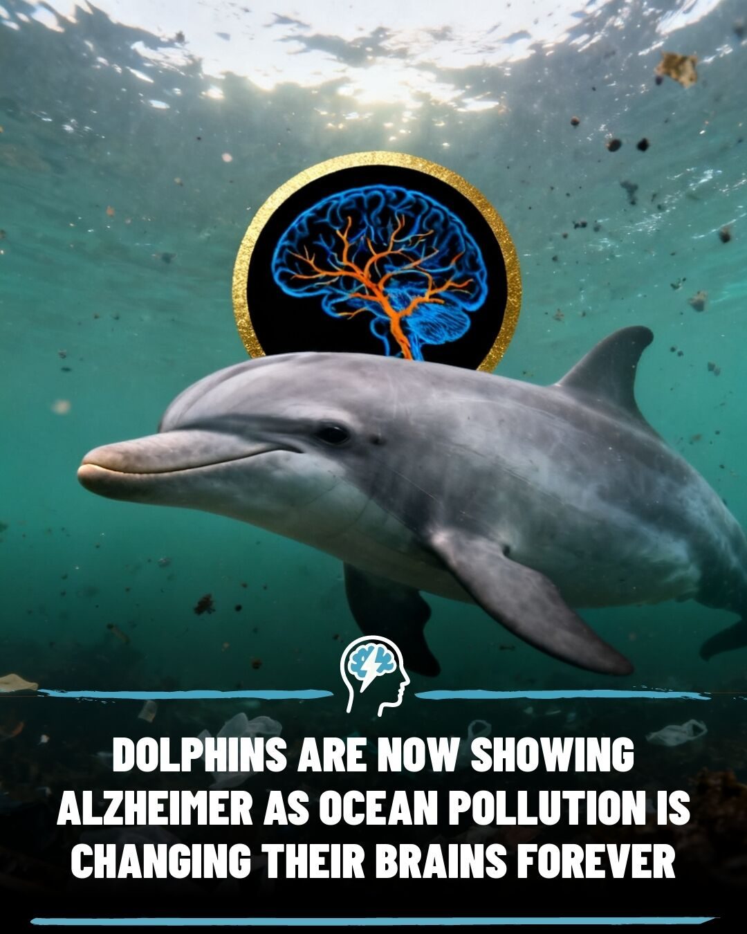 How Ocean Pollution May Be Causing Alzheimer's in Florida Dolphins