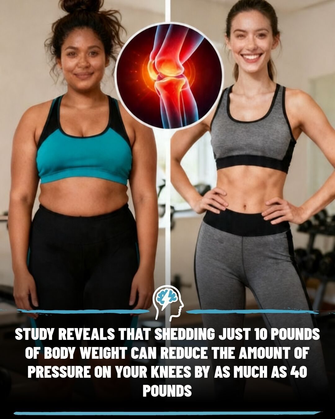 Weight Loss: How Losing 10 Pounds Eases Knee Pressure