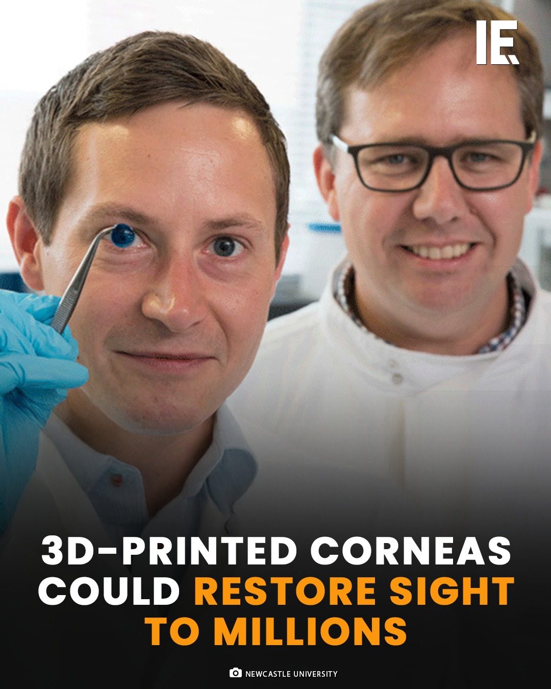 3D-Printing Corneas: A Revolution in Vision Restoration