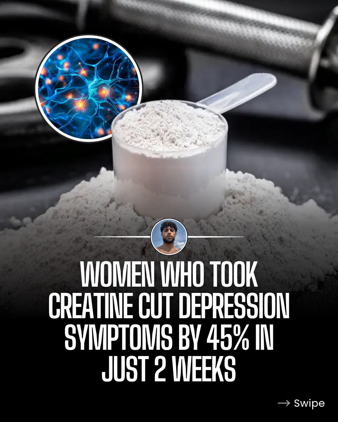 Creatine's Potential: Reducing Depression in Women