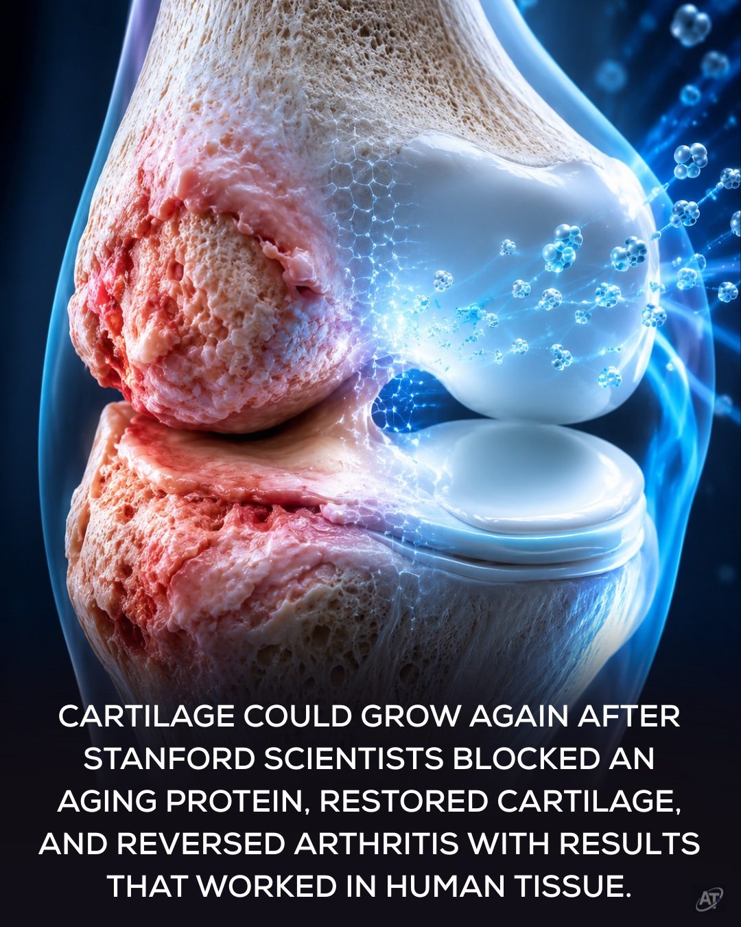 Stanford Breakthrough: Regenerating Damaged Cartilage