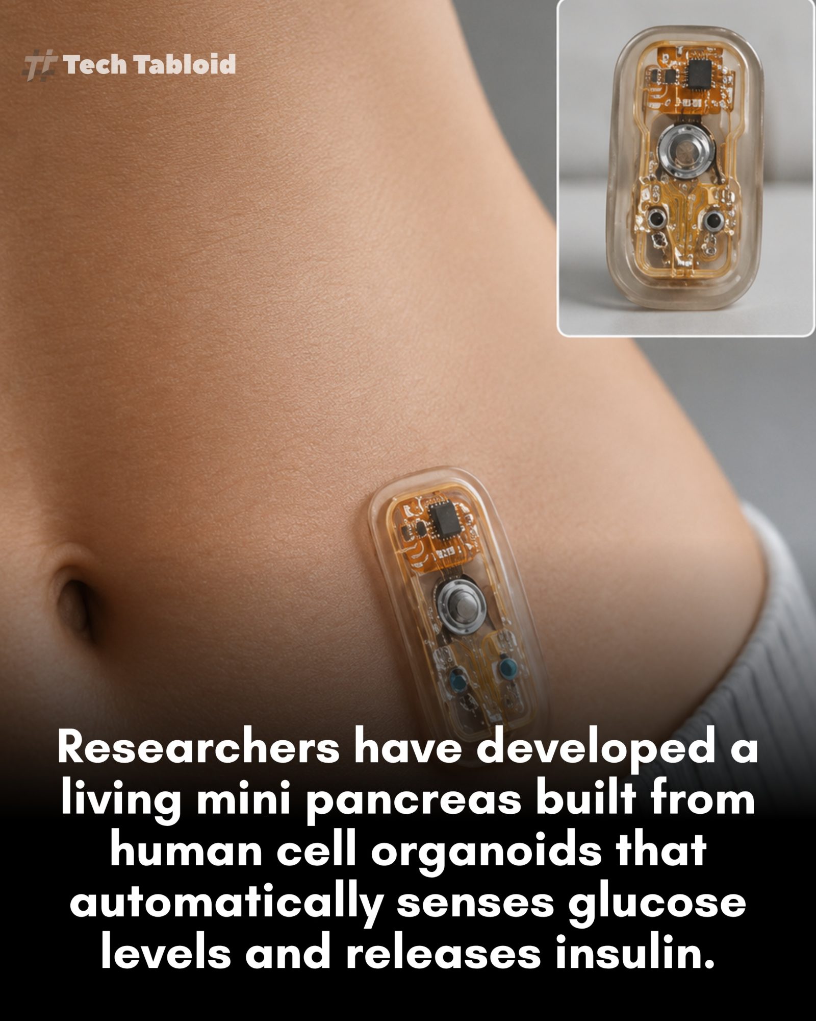 Advanced Mini Pancreas Device: Automating Insulin Release
