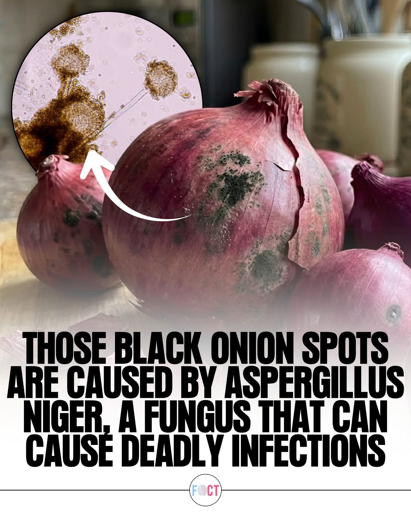 Onion Fungus Risk: Aspergillus Niger