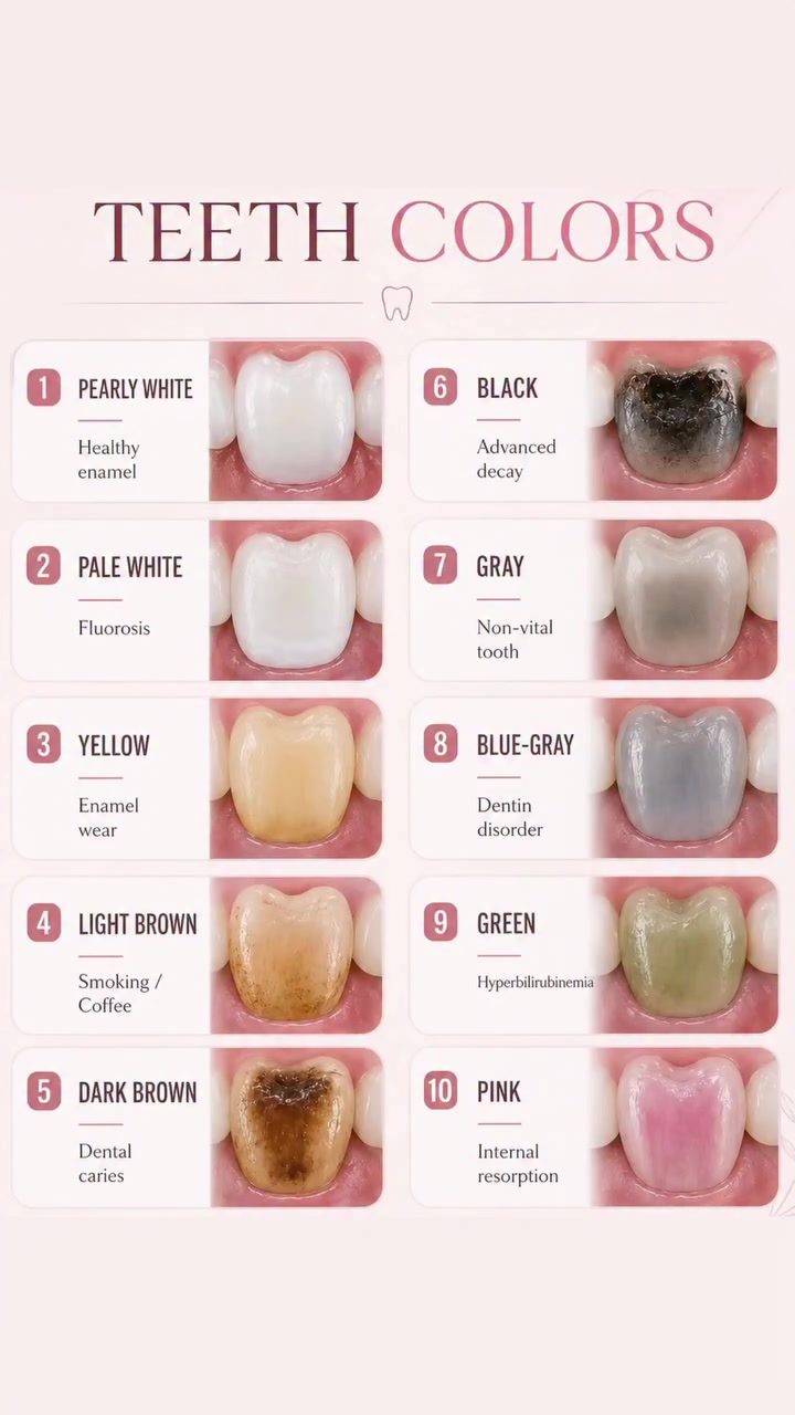 Understanding Tooth Colors: Signs of Dental Health
