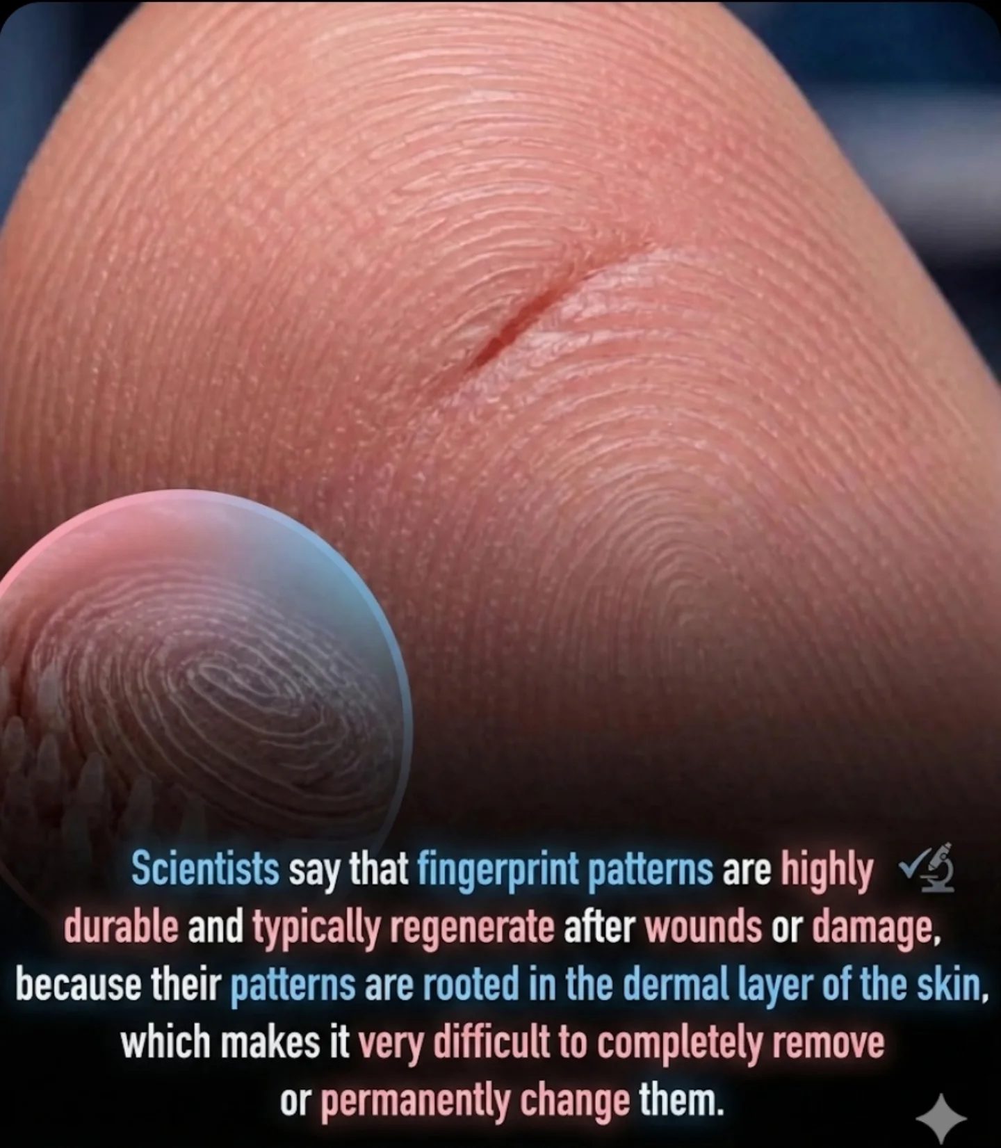 Unlocking the Science: Why Fingerprints Regenerate After Injury