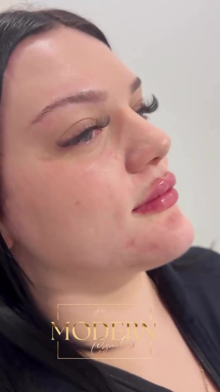 Discover Modern Cosmetics' Personalized Lip Enhancements