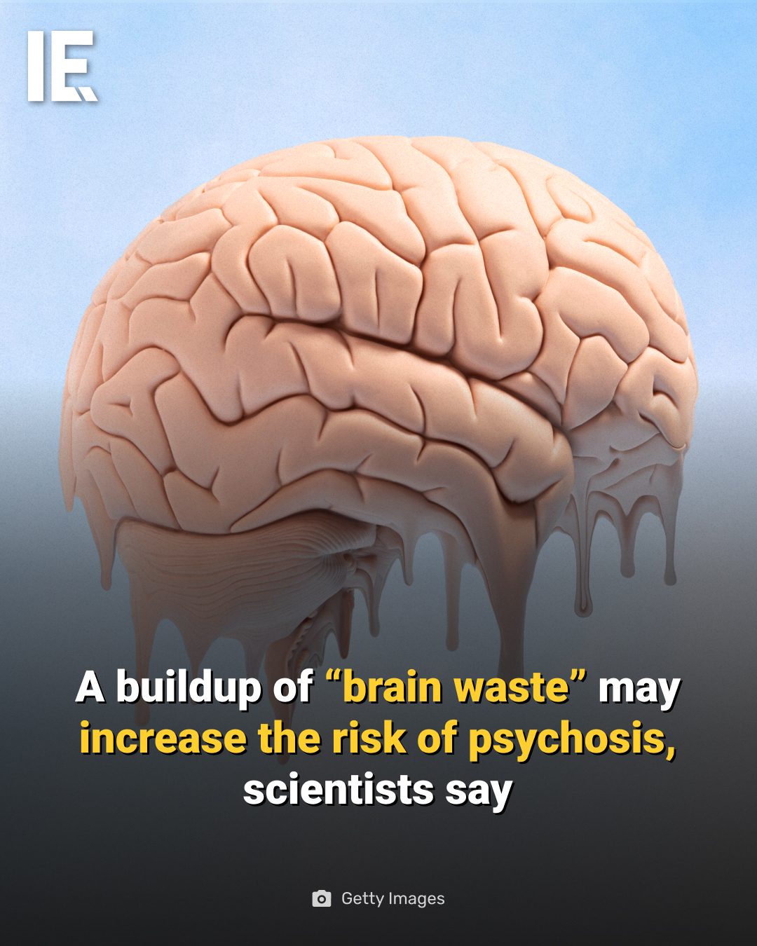 New Study Links Brain Waste to Psychosis Risk