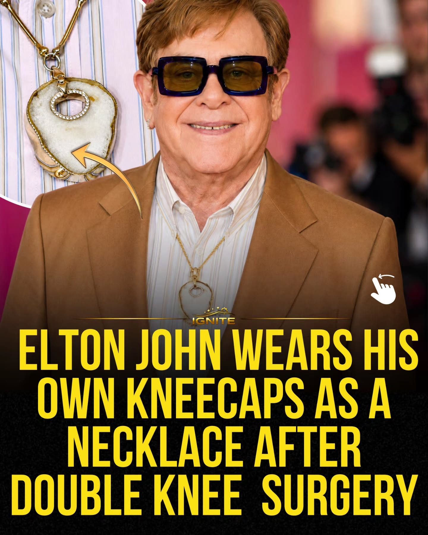 Elton John's Knee Cap Necklace After Double Surgery