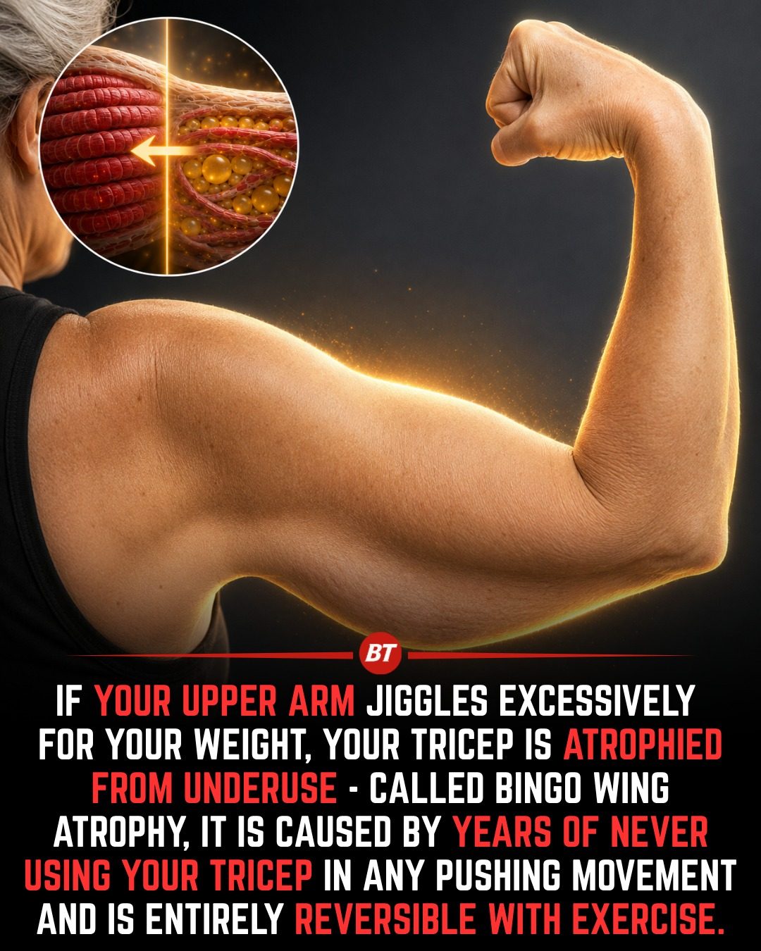How to Reverse Bingo Wings: Tricep Exerciseerises that Work