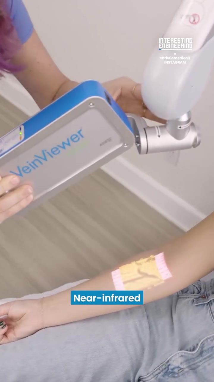 VeinViewer Technology: Revolutionizing Vein Location for Medical Procedures