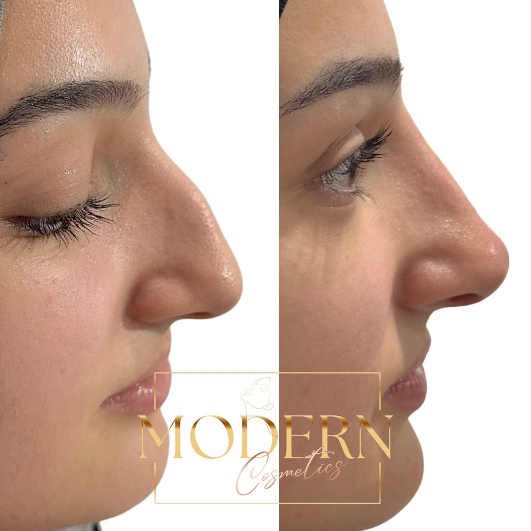 Eyebrow Transformation: Modern Cosmetics' Artistic Approach
