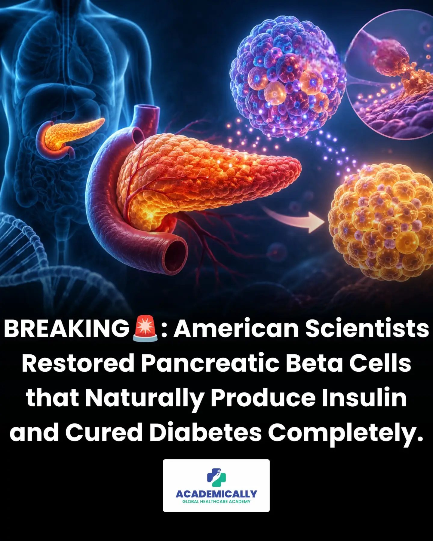 Breakthroughs in Type 1 Diabetes: Restoring Beta Cells