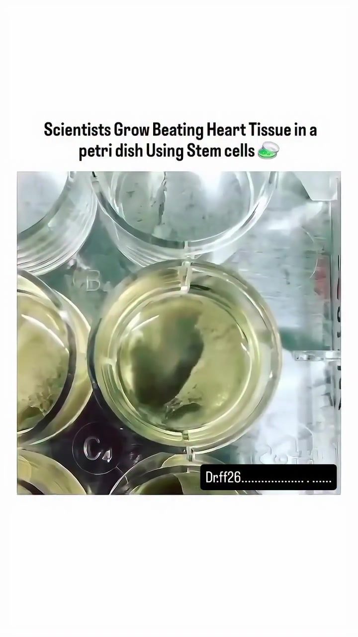Scientists Grow Human Heart Tissue Using Stem Cells