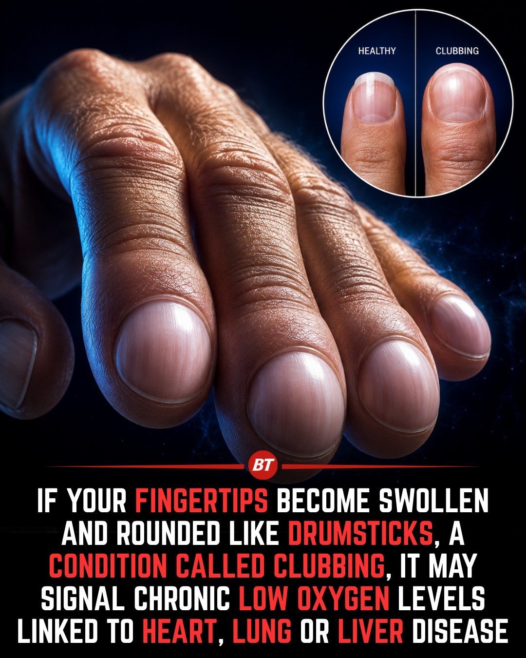 Understanding Digital Clubbing: Silent Sign of Health Issues